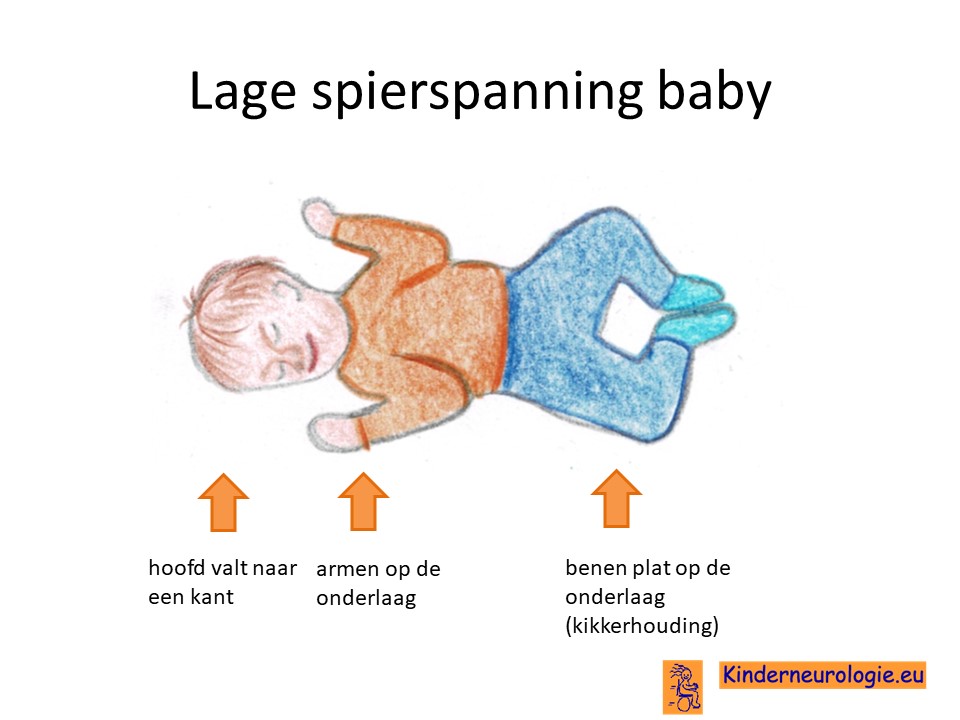 lage spierspanning